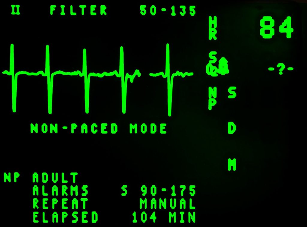 electrocardiogram-16948_1280