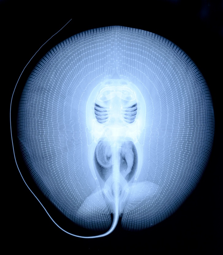 Röntgen: 10 obyčajných vecí, ktoré RTG žiarenie ukazuje v úplne inom svetle